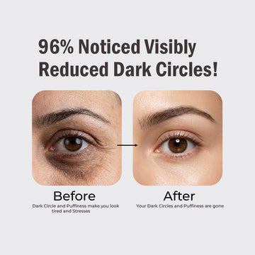 Under Eye Serum